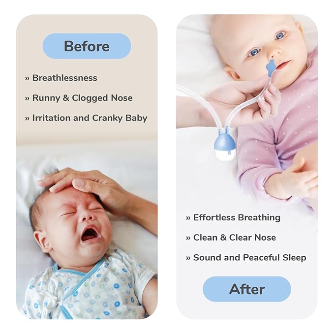 R for Rabbit Snowy Nasal Aspirator – BPA-Free, Anti-Backflow, Easy-to-Clean with Antibacterial Filters & Compact Design for Safe Baby Care